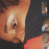 Vessel Damage and Crystallized Eyes