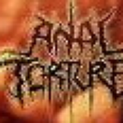 anal torture