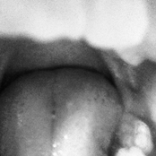 Torsion