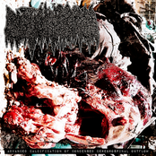 Advanced Calcification Of Condensed Cerebrospinal Outflow