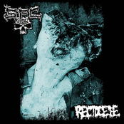 SxFxCx (side) split with Rectocele