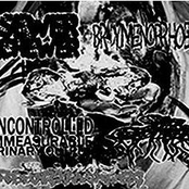 5-Way Reekorrhoea Split