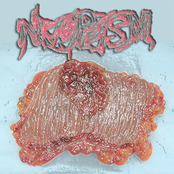 neoplasm