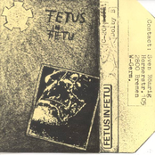 Fetus in Fetu