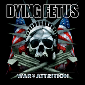 Parasites Of Catastrophe by Dying Fetus