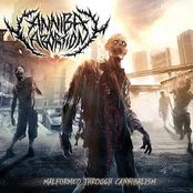 Malformed Through Cannibalism - EP