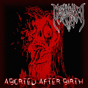 Aborted After Birth