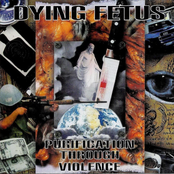 Blunt Force Trauma by Dying Fetus