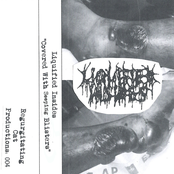 Covered With Seeping Blisters