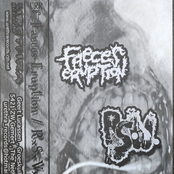 Faeces Eruption / RxSxVx