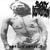 Morgue Morsels
