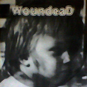 Woundead