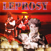 Leprosy: Llora Chiapas