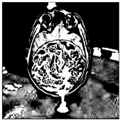 Cerebrum Daemonia
