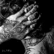 SCARS
