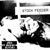 Laceration Of Abdominal Wall & Evisceration (EP)