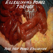 Tool Shed Bowel Evacuation