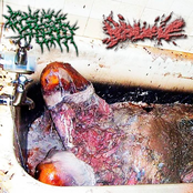 The Castrull Of Borsch / Hydrocele