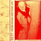 Delta-Sleep-Inducing Peptide