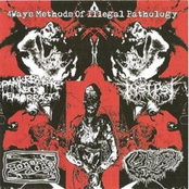 Boneache / Pancreatite Necro Hemorragica / Insepsy / Fetal Deformity