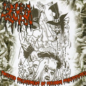 Twisted Treatement Of Perodic Prostitutes