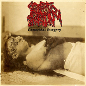 Genocidal Surgery