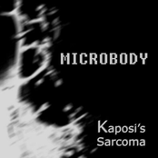 Kaposi's Sarcoma