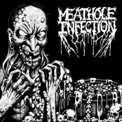 Necrovorous / Meathole Infection
