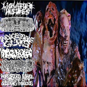 Liquified Insides / Butyric Fermentation Abuse / Indigestable Guts / Hydrocephalus / Wormclogged Blisters / Perforated Bowel Syndrome With Oozing Faeces