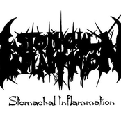 Stomachal Inflammation