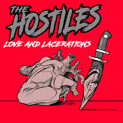 Love and Lacerations