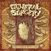 Unruly Dissection Marathon by General Surgery