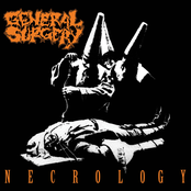 General Surgery: Necrology