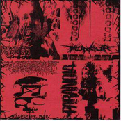 Paranoia / Tumour / Pulmonary Fibrosis / Takashi Ohkawa