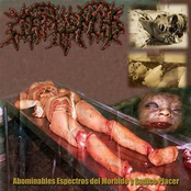 Abominables Espectros Del Morbido Y Sasdico Placer