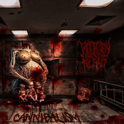 Cannibalism