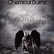 Chemical Burns
