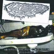 ABORTION SECONDS COMPILATION 2010-2020
