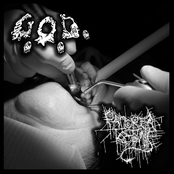 Successfully Re-emboweled (split with GOD)