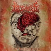 Fatal Cerebral Lesions