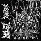 Bloodletting