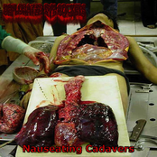 Nauseating Cadavers