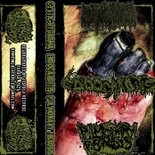 3ways Split w/ Cystic Hygroma & Pulmonary Fibrosis