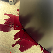 n1gga bleeding in the van