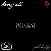 Scars
