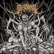 Cranial Hemorrhagic Dissection