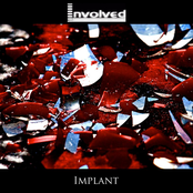 Implant EP