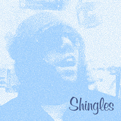 Shingles