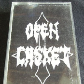 Open Casket