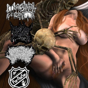 Vaginal Erection / Pornthegore / Candidal Vulvovaginitis / Pornoise